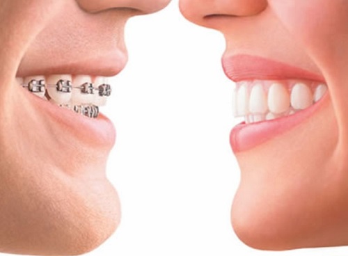Спільна робота ортодонта та стоматолога